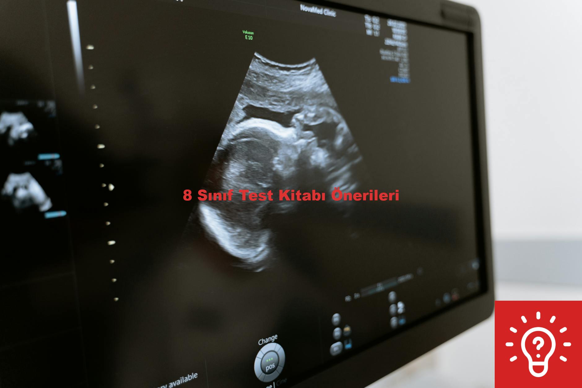 8 Sınıf Test Kitabı Önerileri